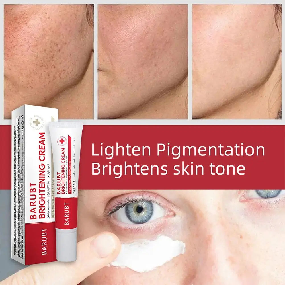 Whitening Freckles Face Cream Removal Melasma Dark Spots Corrector Lighten Melanin Pigmentation Brighten Beauty Care