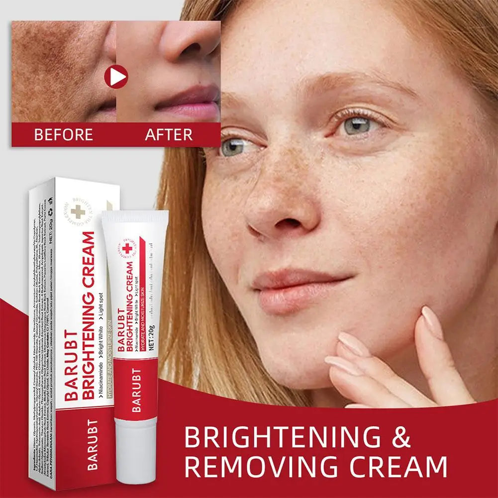 Whitening Freckles Face Cream Removal Melasma Dark Spots Corrector Lighten Melanin Pigmentation Brighten Beauty Care